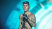 GALA VIDÉO - Justin Bieber paralysé du visage : il doit annuler de nouveaux concerts