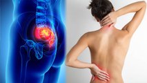 महिलाओं के कूल्हे में दर्द हो क्यों होता है | महिलाओं के कूल्हे में दर्द का कारण |Boldsky*Health