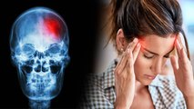 लगातार सिर दर्द क्यों होता है, लगातार सिर में दर्द रहना इस गंभीर बीमारी का लक्षण | Boldsky*Health