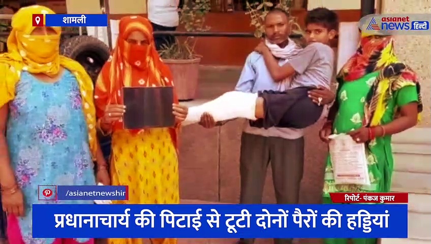 शामली में प्रधानाचार्य की पिटाई से टूटी छात्र के दोनों पैरों की हड्डियां, वजह जानकर हर कोई हुआ हैरान