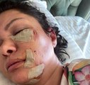 Son dakika haberi... Ünlü şarkıcı Tuğba Altıntop köpek saldırısına uğradı