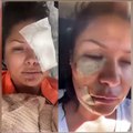 Köpek saldırısına uğrayan şarkıcı Tuğba Altıntop’un yüzüne dikiş atıldı