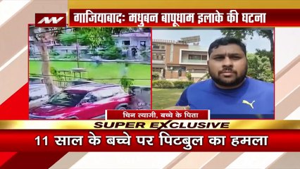 Uttar Pradesh Breaking : Ghaziabad में पिटबुल डॉग ने बच्चे के मुंह पर किया अटैक | UP News |