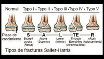 Fractura Salter y harris