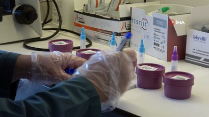 Koronavirüsle ilgili çarpıcı araştırma ortaya çıktı: Sigara içen herkesi ilgilendiriyor