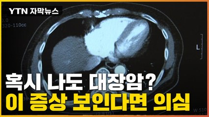 [자막뉴스] 혹시나 했는데 '대장암' 진단...젊다고 안심하면 금물 / YTN