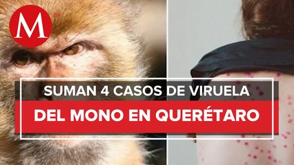 Querétaro reporta cuarto caso de la viruela del mono