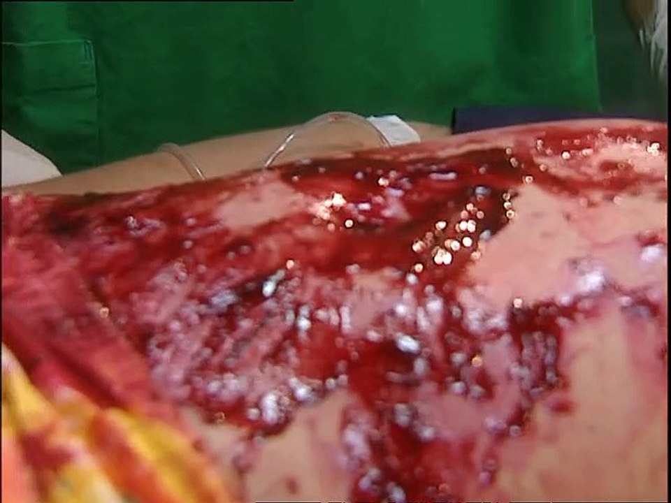 Alphateam - Die Lebensretter im OP Staffel 3 Folge 7