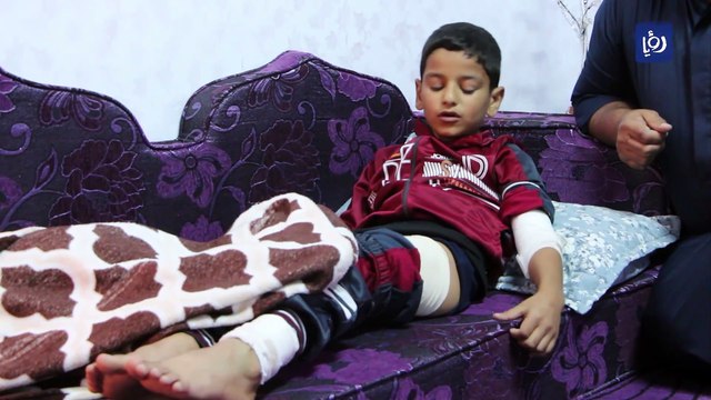 الكلاب الضالة تعقر سيدة وأربعة أطفال في الطفيلة