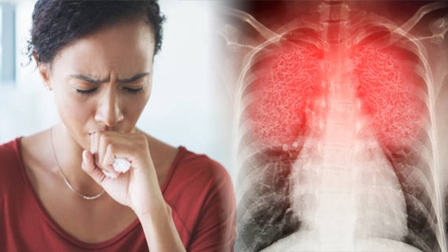 सुबह खांसी क्यों आती है, सुबह उठने पर खांसी आना इस गंभीर बीमारी का लक्षण | Boldsky *Health