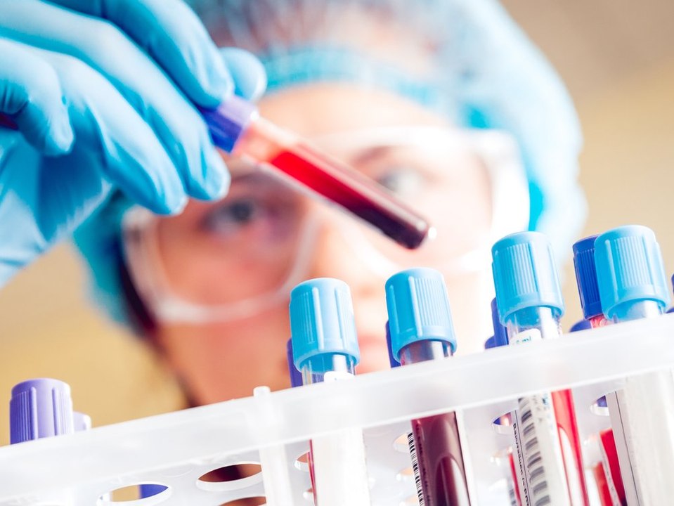 Durchbruch: Neuer Bluttest erkennt über 50 Krebsarten
