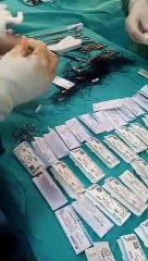 Ameliyatlarda kullanılan dikiş iplerinde skandal