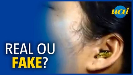 Fake ou real? Cobra em ouvido humano viraliza