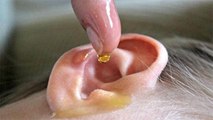 कान में सरसों का तेल डालने से क्या होता है । कान में सरसों का तेल डालने के नुकसान । Boldsky *Health