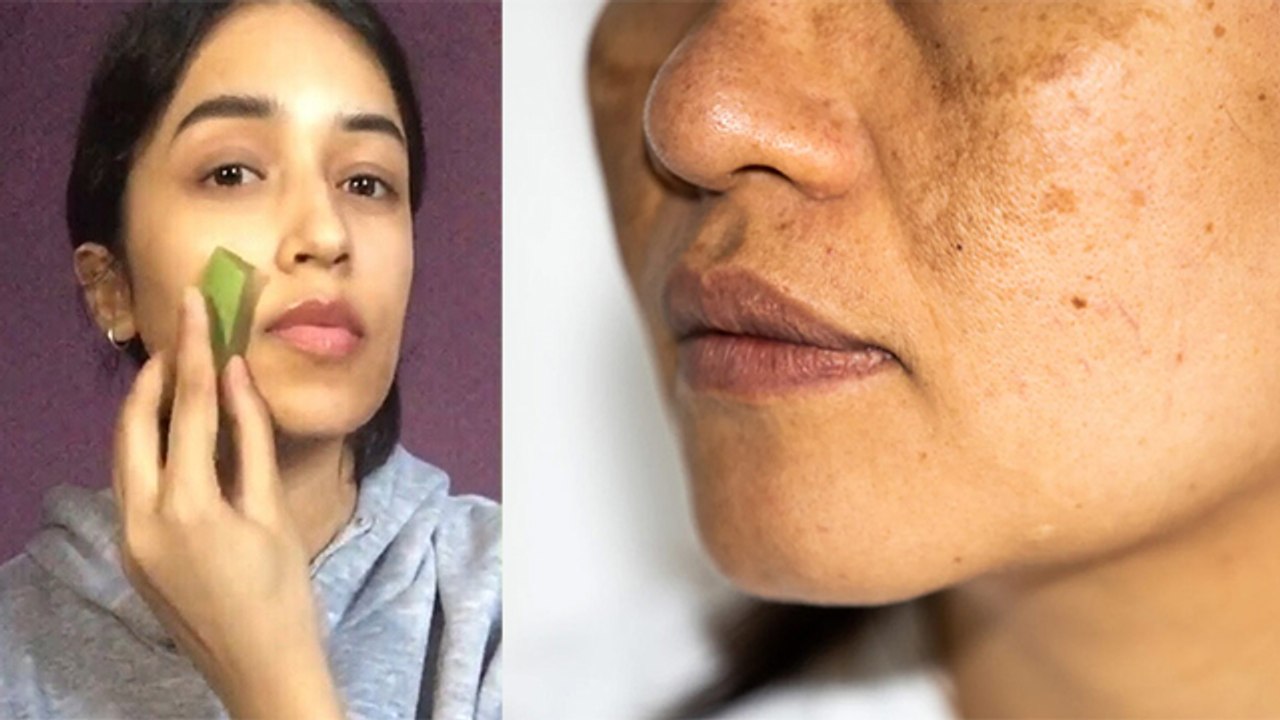 चेहरे पर एलोवेरा जेल लगाने से होते है गंभीर नुकसान।Face Par Aloe Vera Gel Lagane Ke Nuksan*Health