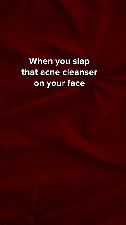 If acne could talk - Good Omens #shorts   Prime Video
