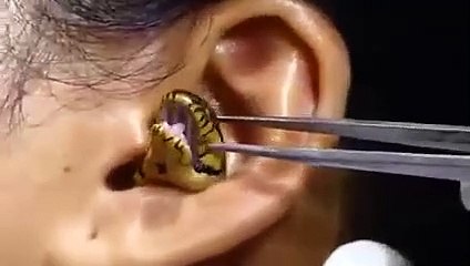 Mujer con una serpiente metida en la oído que horrorizó a internet