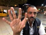 Elazığ haber... Elazığ'da 11 parmaklı adam görenleri hayrete düşürüyor