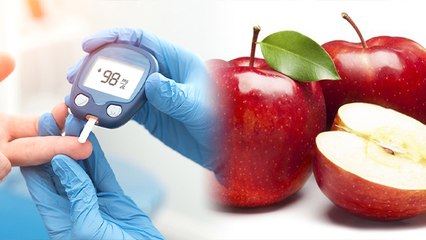 Diabetes Patients को  Apple खाना चाहिए कि नहीं । Expert Advice | Boldsky *Health