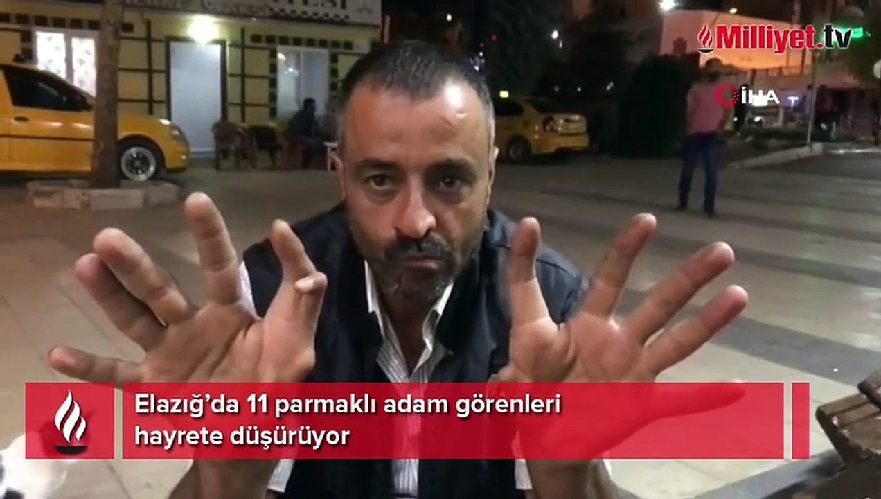Elazığ’da 11 parmaklı adam görenleri hayrete düşürüyor