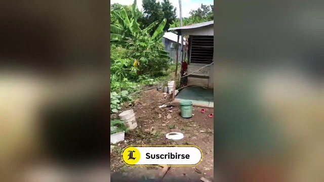 Yo quiero que me operen y restaurar mi salud , clama hombre que tiene 5 meses con tres fracturas en una pierna