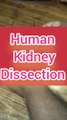 Human kidney dissection||parts of kidney||parts of human kidney||dissection of human kidney showing every parts