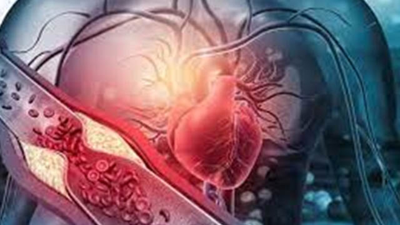 बैड कोलेस्ट्रॉल क्या होता है । बैड कोलेस्ट्रॉल के क्या है लक्षण । Boldsky *Health