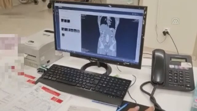 İran uyruklu 5 şüphelinin vücudundan 683 kapsül uyuşturucu çıktı