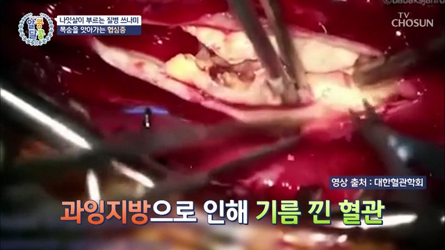 밀려오는 질병 쓰나미 원인은 바로 나잇살 TV CHOSUN 20220915 방송