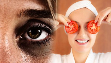 Dark Circle को हमेशा के लिए खत्म करेगा टमाटर,बस जान लें इस्तेमाल करने का तरीका | Boldsky *Health