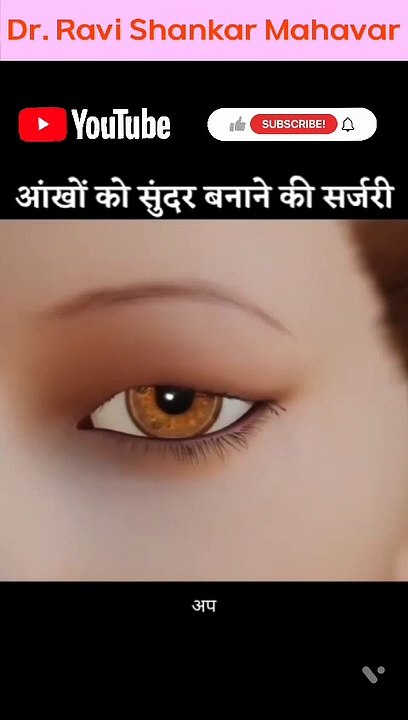आंखों को सुंदर बनाने की सर्जरी | Aankho  Ko Sunder Banane Ki Surgery