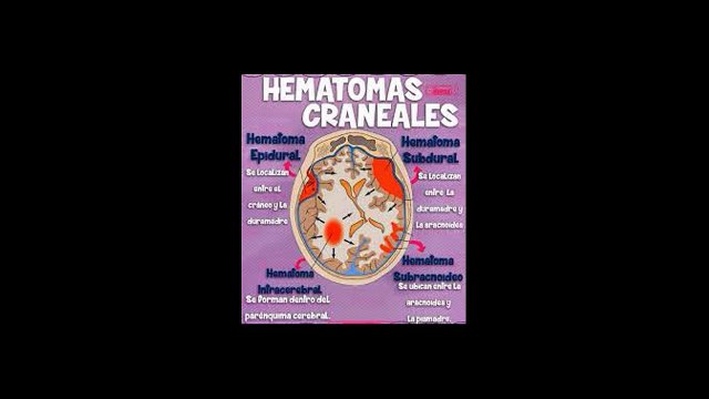 hematomas cerebrales