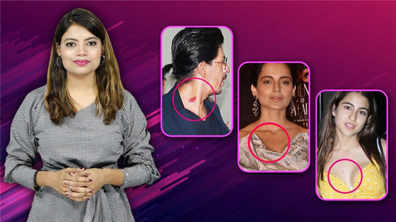Bollywood Celebrities Love Bites List Viral, Me...