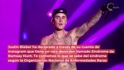 ¿Qué es el síndrome de Ramsay Hunt? La rara enfermedad que carga Justin Bieber