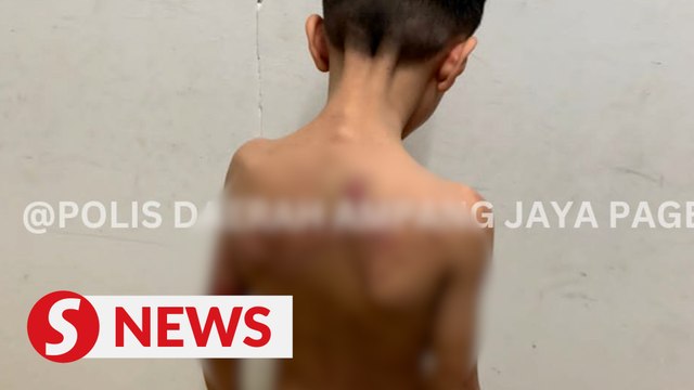 Couple who allegedly abused nephew, niece remanded for a week