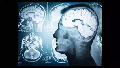 Mediametros de las patologías cerebrales