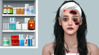 AAMR Eye discharge removal animation - Eyelid big acne extrusion and lashes lice deep cleaning(1080P_HD)