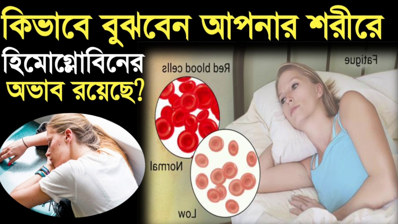 হিমোগ্লোবিন কম হওয়ার লক্ষণহিমোগ্লোবি বাড়ে কোন খাবারেHemoglobin