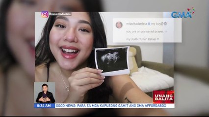 Rita Daniela, ipinasilip ang ultrasound ni Baby Juan "Uno" Rafael | UB UB_091922_14.jpg