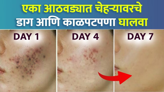 7 दिवसात मिळवा clear आणि glowing skin | how to get clear skin naturally | glowing skin challenge