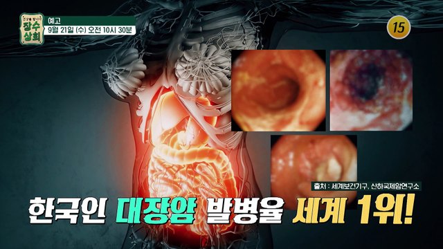 장 건강지키고, 변비 개선까지! 장수상회에서 공개합니다!_장수상회 11회 예고 TV CHOSUN 220921 방송