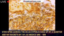 STDs spike across the US as syphilis goes up by a QUARTER and HIV rockets by 16% as medics urg - 1br