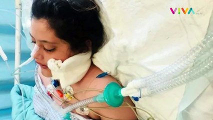 Perempuan Iran Ramai-ramai Bakar Jilbab, Ini Penyebabnya!