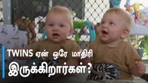 Twins | யாருக்கெல்லாம் இரட்டை குழந்தைகள் பிறக்கும்?