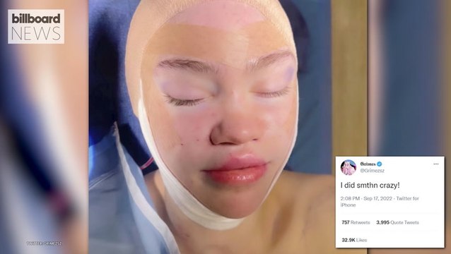 Grimes Shares Post Surgery Photo & Fans Are Convinced She Has Elf Ears | Billboard News