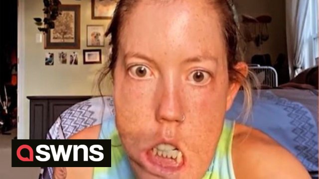 US mum with facial condition is teaching her four adopted sons to ask questions but be kind