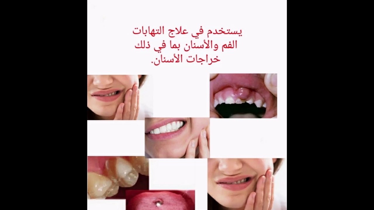 Birodogyl لعلاج مشاكل الأسنان