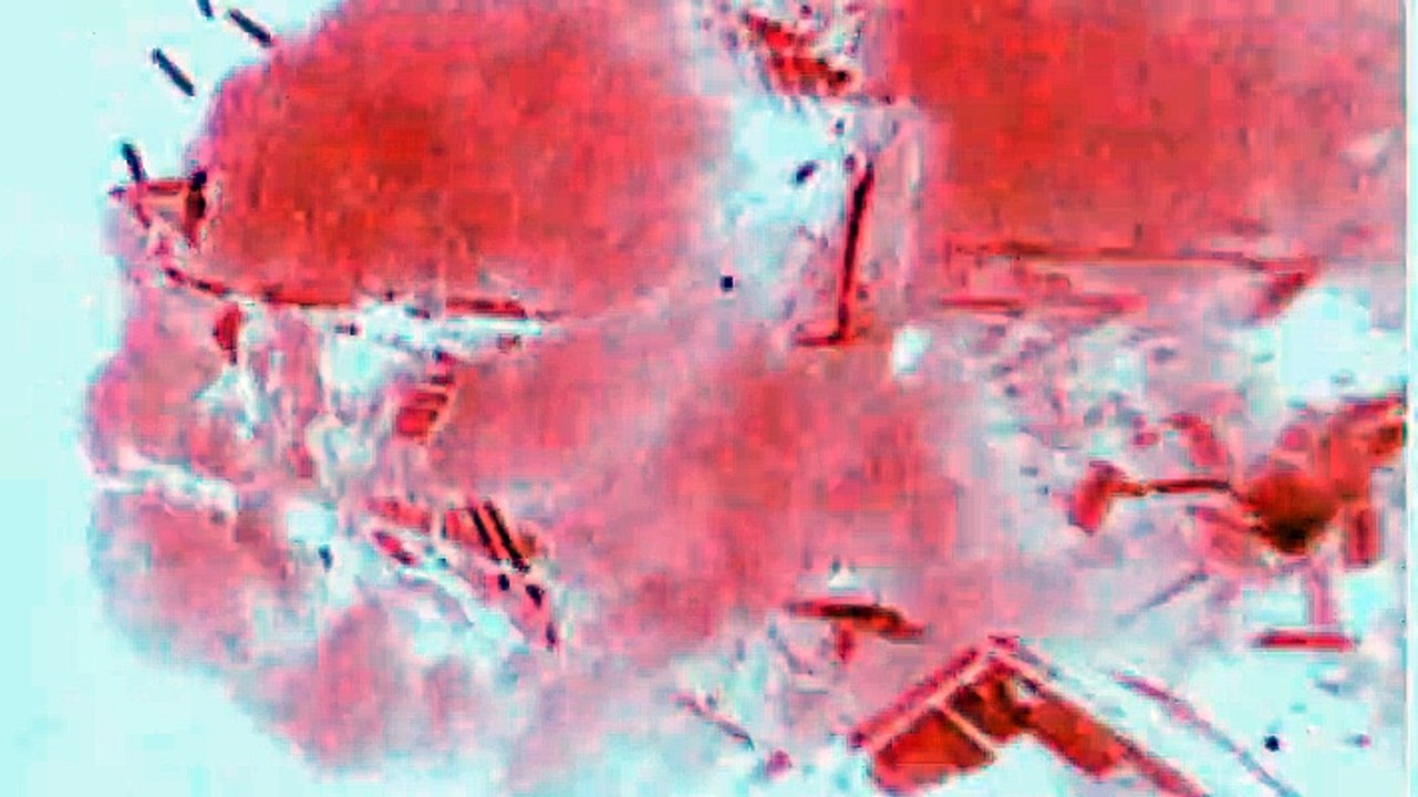 Millennium - Fürchte deinen Nächsten wie Dich selbst Staffel 2 Folge 8 HD Deutsch