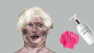 AAMR Blackhead removal for 70 years old homeless woman _ Skin care animation(2K_HD)