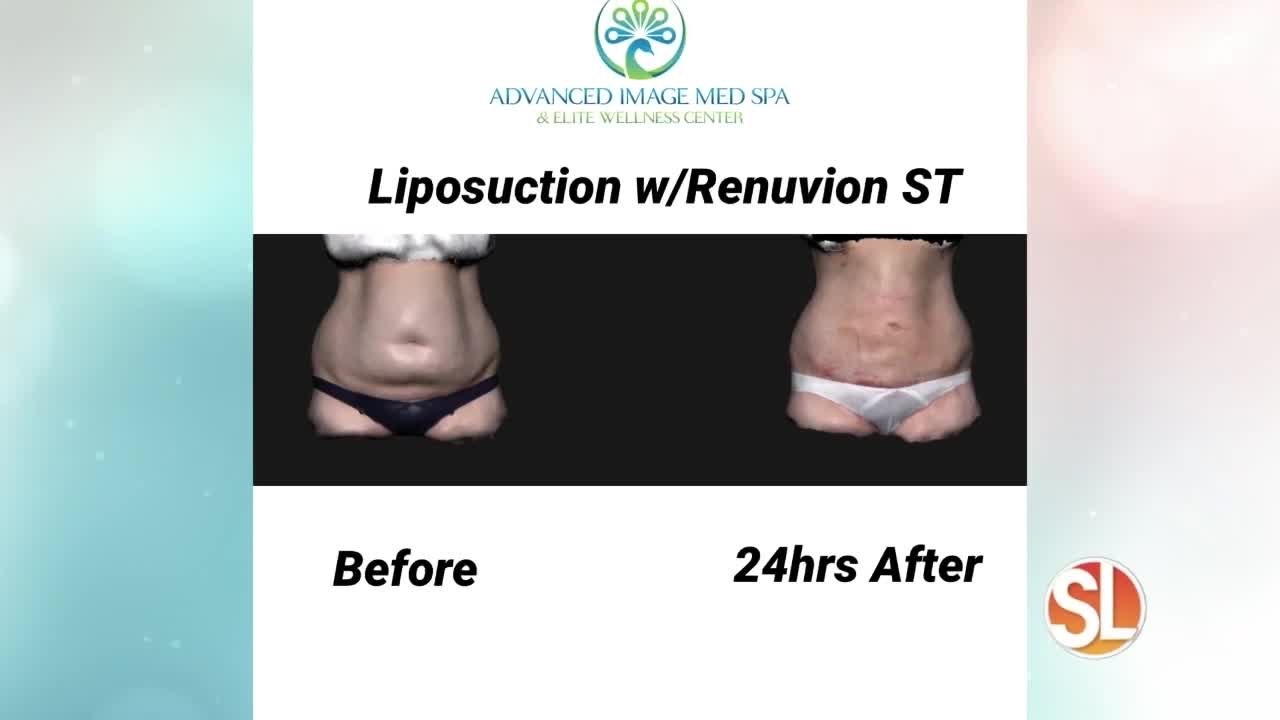 Want to look younger naturally? Advanced Image...